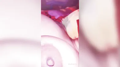 XXX sex bediou fisting